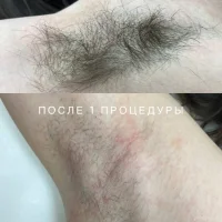 центр эпиляции и косметологии на сходненской улице изображение 7