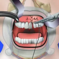 стоматология и косметология зубок на преображенской площади изображение 5
