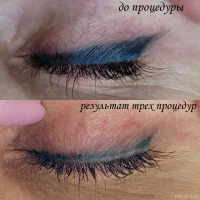 студия перманентного макияжа и удаления тату саушкиной ирины изображение 3