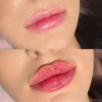 клиника эстетической косметологии a/r косметология изображение 18